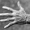 Soins articulaires